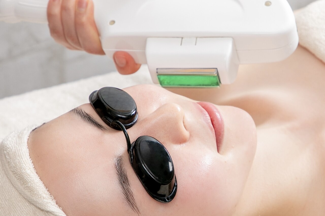 【美肌になれる脱毛 | 55％OFF】美肌顔脱毛　￥6600→￥2980