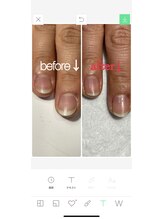 ラフ(rough)/No.6と同じ方のお爪