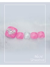 はあとねいる 野々市駅前店/フットネイル：No.76