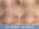 シュリー(Sriii)の写真/毛穴レスな肌になる！ワイコ水光ピール/乳酸ピーリング/エンビロン/セルマン/集中ケアで土台から美肌へ♪