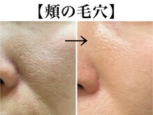 ベアトリーチェ 五反田(Beatrice)の雰囲気（年齢より老けて見える原因を徹底ケア毛穴洗浄/毛穴ケア/五反田）