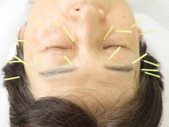 南花畑接骨・鍼灸マッサージ院/