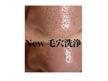 ラウレア(Laule’a)の雰囲気（綺麗を更新し続けれる、汚れが戻らない毛穴洗浄！）