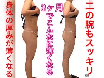 アールズ スリム(R's slim)/本格痩身デコボコが気になる方★