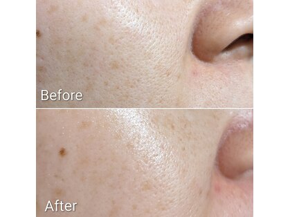 アロマサロン フランジパニ 枚方(Frangipani)の写真