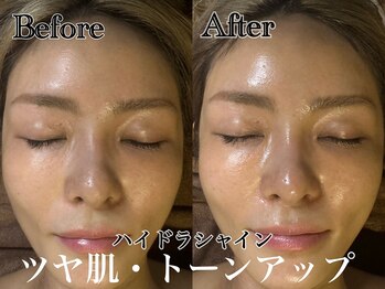 アンドエス 六本木(and S.)/ハイドラシャインでツヤ肌☆