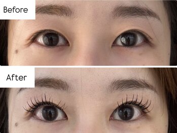 オルテンシア 六本松(ORTENSIA)/エクパーマ！プラス30分の魔法