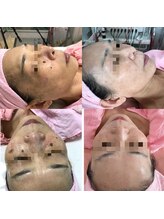 プリエール ビューティ/