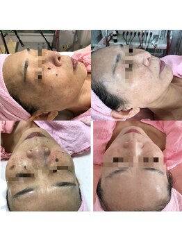 プリエール ビューティ/