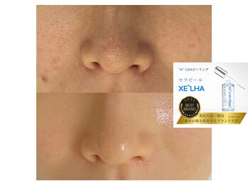 リシェリ 代官山(RICHERI)/ララピールの進化版!セラピール