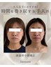 【8月13日21日★限定】【本気のお悩みに】頭蓋骨小顔矯正×美肌ケア