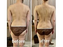 リムアール(Limh R)/ブライダル