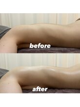 リラ(Lilas)/施術後スッキリ♪