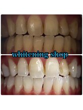 ホワイトニングショップ 越谷店/