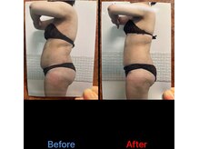 ガネェーシャ(Ganesha)/気になる脂肪に。最強サーモ