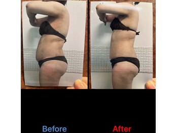 ガネェーシャ(Ganesha)/気になる脂肪に。最強サーモ