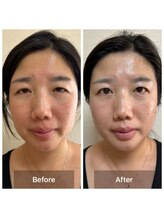 サロン ド アヤ(salon de Aya)/エイジング+小顔術