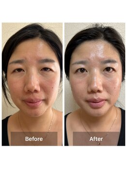 サロン ド アヤ(salon de Aya)/エイジング+小顔術