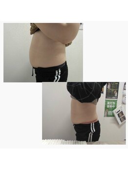 ゴールデンエイジ(Golden Age)/脂肪冷却でサイズダウン★