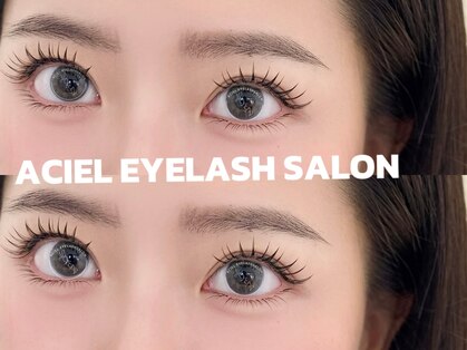 エイシェルの写真