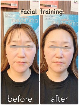 ヴィエンナ VIENNA/【小顔】脂肪を分解/輪郭引締め