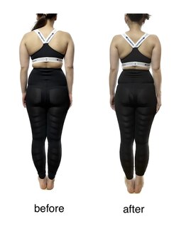 リニューアル(renewal)/背中すっきりもお任せください！