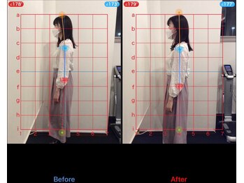 ケアハウス 藤沢(CARE HOUSE)/施術効果写真☆(before after)