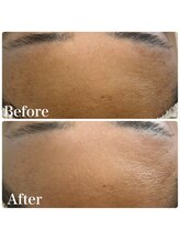 エルドットサナ(L.sana)/フェイシャルワックス