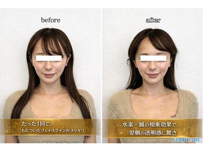 ハリケア 麻布十番院(HARICARE)の写真