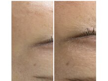 サロン コト(Salon Coto)/韓国水光生美容液フェイシャル