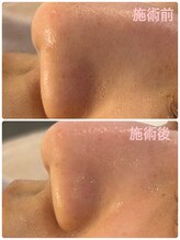 マナ(mana)/【黒ずみ解消】30分でツヤ肌へ