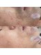 ラ ルアナ(La Luana)の写真/最新のLED脱毛機で肌の弱い方でも可能な脱毛を体験！アフターケアまでしっかりサポート◎