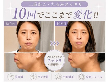 カンワ美容鍼灸院(KANWA美容鍼灸院)の写真