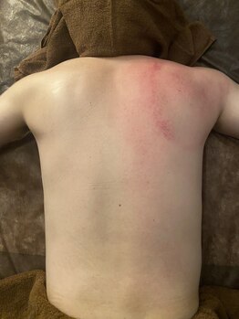 リベル(Liber)/ゴルフ疲れのお体に筋膜リリース