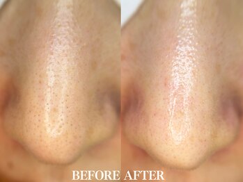 サロン ムスブ(salon MUSUBU)/山梨エステ/甲府エステ