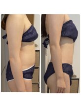 アンサー(ANSWER)/目標のボディラインへ