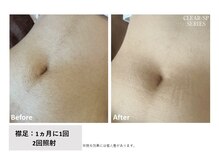 ル リアン(Le Lien)の雰囲気（「抜ける」「お肌が綺麗に◎」と嬉しいお声を頂いております♪）