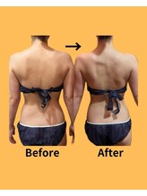 ビューティースタイリング 恵比寿店(beauty styling)/【ボディ】ぽっこり肩こり改善☆