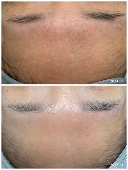 ヒルナム(Heal Nam)/プロセルセラピーズ~フェイス~