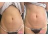 【ガッツリ体重を落としたい★】痩身3か月通い放題プラン◆1回60分/139800円