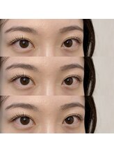 シアミス(SIAMIHS)/エクステパーマ