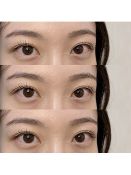 シアミス(SIAMIHS)/エクステパーマ