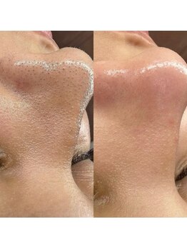 リー ビューティースパ 川崎(Ri beauty spa)/