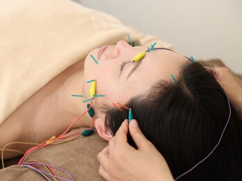 美鍼堂の写真/深層筋まで届く電気美容鍼で食いしばり・エラ張りをほぐし。首肩鍼付き、速攻小顔でフェイスラインすっきり