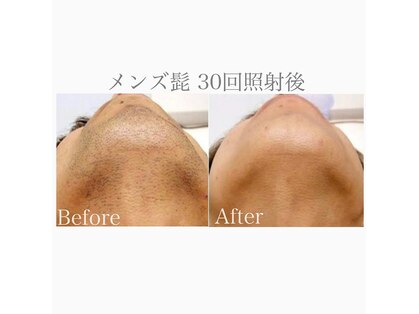 ハイリー(Hily)の写真