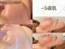 ひっそり美肌構築