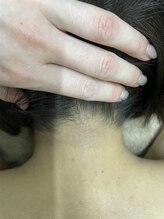 ナノハナ/鹿沼市の全身脱毛のナノハナ