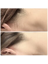 サロン ド マリ(Salon De Mari)/ムダ毛は脱毛で除去！