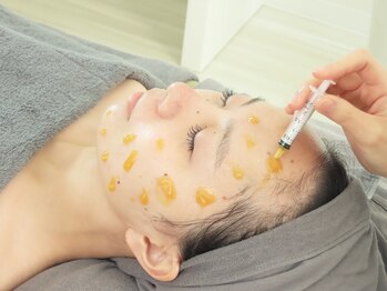 ソワン(Sowan)/韓国マイクロニードルピーリング