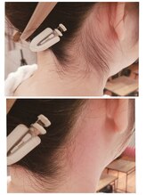 プトゥリ(Putri)/うなじWax脱毛